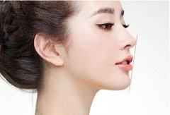 隆鼻手術(shù)恢復(fù)時(shí)間方法有哪些