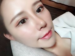 鼻小柱手術(shù)多久才可以恢復(fù)好呢